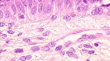 Microscope image of mucosal tissue